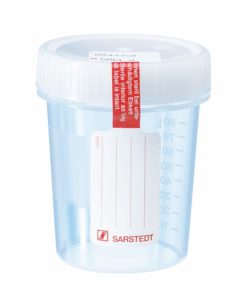 Urine Container with screw cap